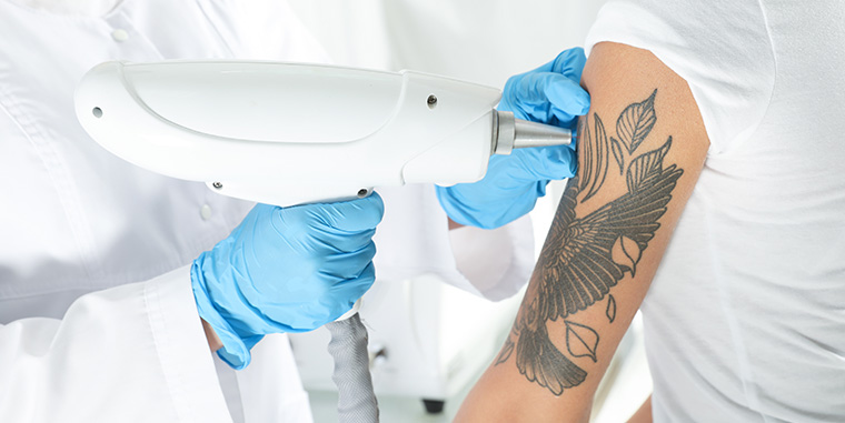 blog-immagine-laser